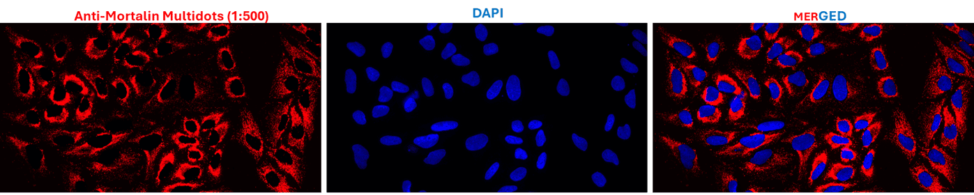 Fluorescence Microscopy